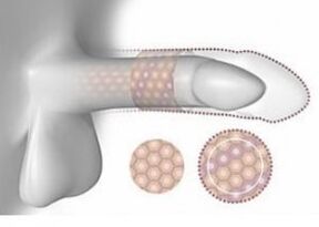 Увеличен пенис в обем