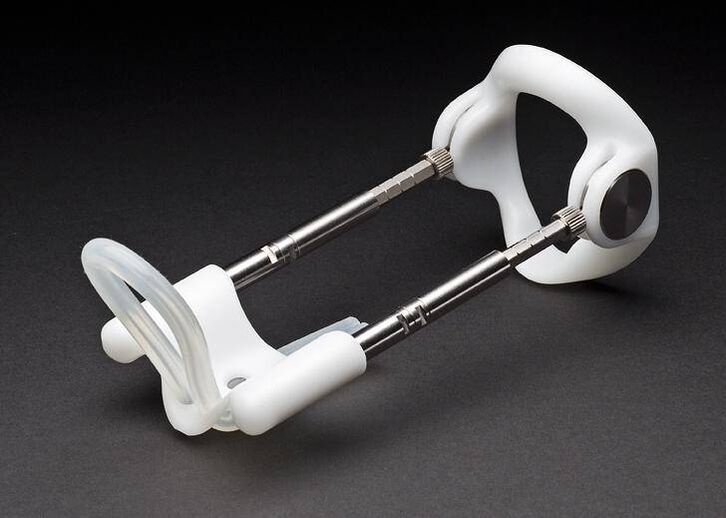 удължител след операция за уголемяване на пениса